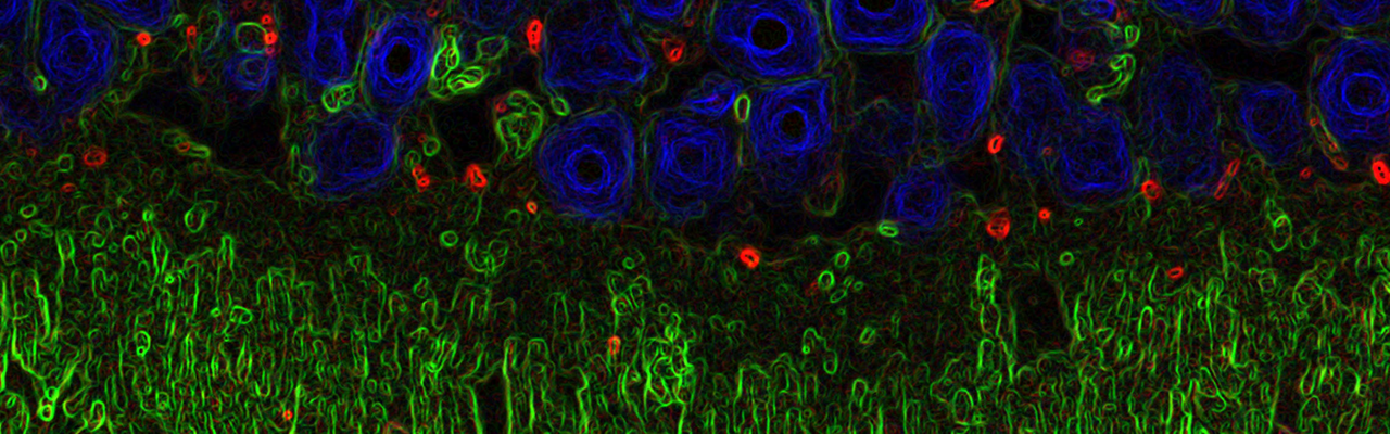 Representation of work from Ian Ganley's lab group