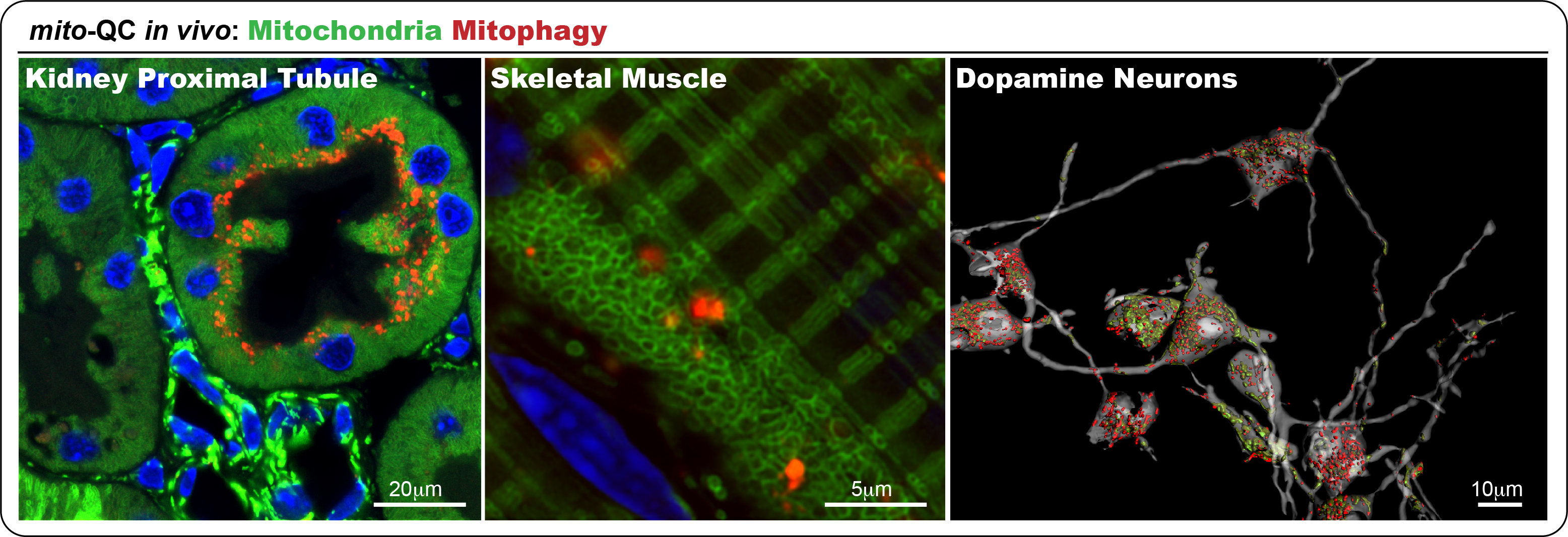 Ganley Lab Research