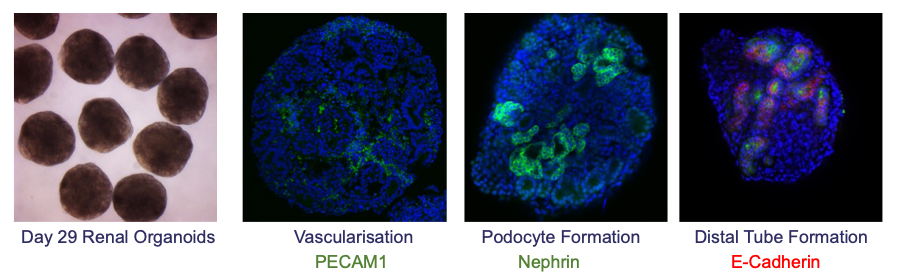 Human kidney organoid development in the ‘Naviplate’