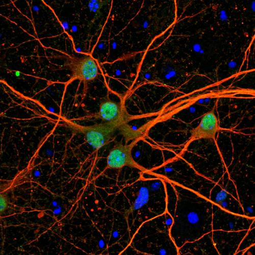 Fetal mouse cortical neurons cultured for 12 days in vitro and stained for RNF12 E3 ubiquitin ligase (green), MAP2 neuronal marker protein (red) and Hoechst for DNA (blue). These images show that RNF12 is localised to the nucleus in neurons, primarily as a result of direct SRSF protein kinase (SRPK) phosphorylation. This confirms that the SRPK-RNF12 axis, a new neurodevelopmental signalling pathway reported in this paper, is active in neuronal cells.